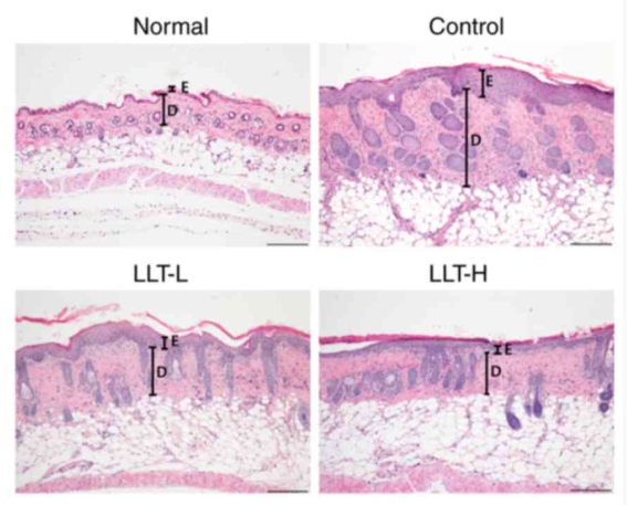 Microscopic skin comparison showing Normal, Control, LLT-L, and LLT-H
